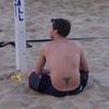 28761 - Tattoo Failure