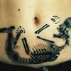 48239 - Tattoo Failure