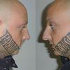 9316 - Tattoo Failure
