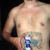 26255 - Tattoo Failure
