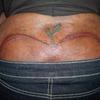 28761 - Tattoo Failure