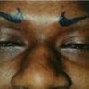 20435 - Tattoo Failure