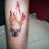 20656 - Tattoo Failure