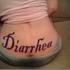 29491 - Tattoo Failure