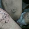 20852 - Tattoo Failure