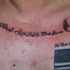 28761 - Tattoo Failure