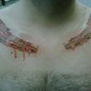 20656 - Tattoo Failure