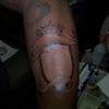 39434 - Tattoo Failure