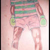 156200 - Tattoo Failure