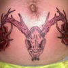 29491 - Tattoo Failure