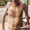 8461 - Tattoo Failure