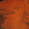 68762 - Tattoo Failure