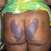 8444 - Tattoo Failure
