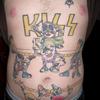 65242 - Tattoo Failure