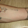8391 - Tattoo Failure