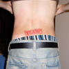 8391 - Tattoo Failure
