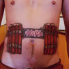 8430 - Tattoo Failure