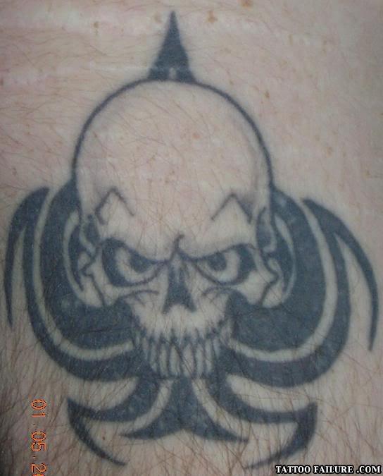 Skull