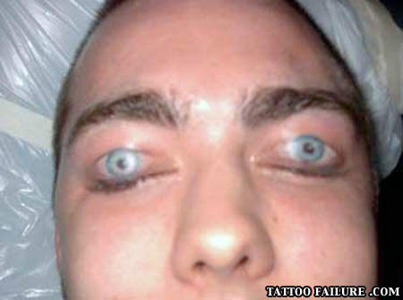 Eyes
