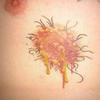 17923 - Tattoo Failure