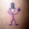 17590 - Tattoo Failure