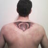 8436 - Tattoo Failure