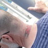 23670 - Tattoo Failure