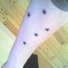 23670 - Tattoo Failure