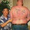 23670 - Tattoo Failure