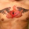 31590 - Tattoo Failure