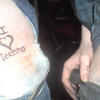 8411 - Tattoo Failure