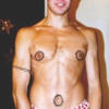 8372 - Tattoo Failure