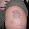 27513 - Tattoo Failure